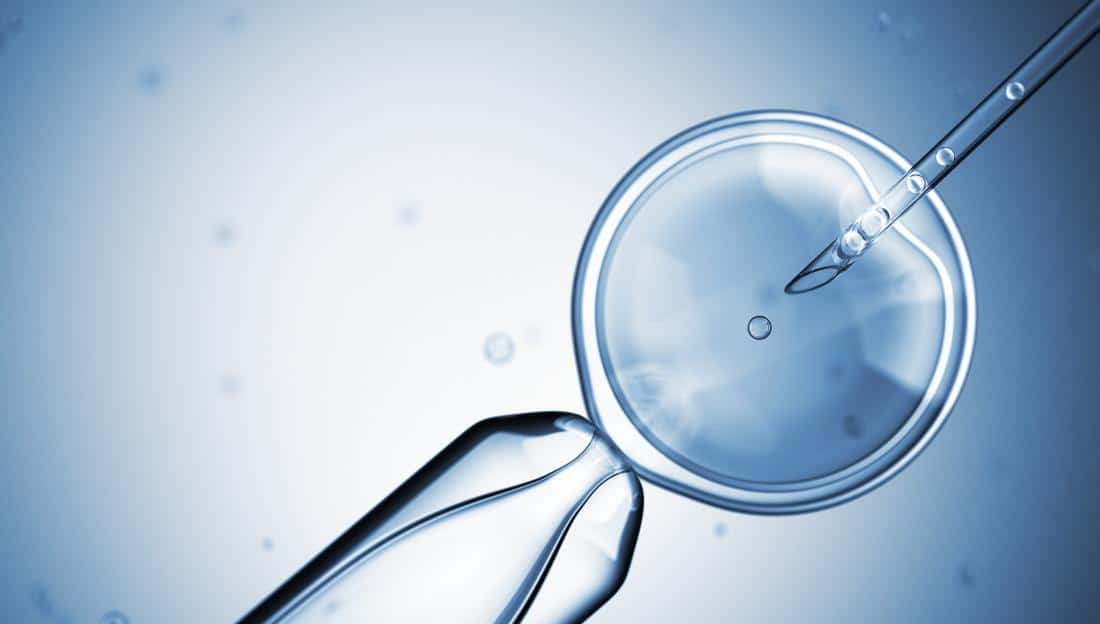Frequently Asked Questions About Stem Cell Therapy - Renovo Health and Beauty