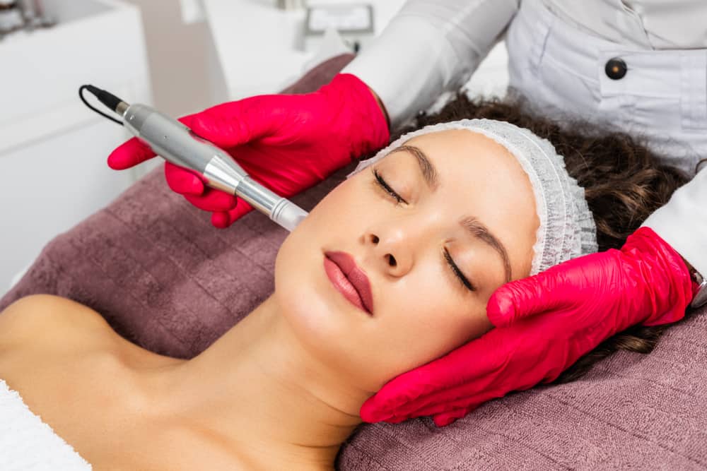 Microneedling in Tijuana