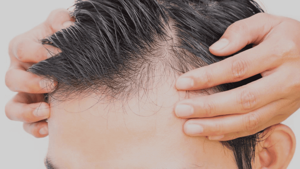 PRP Hair Treatments Cost