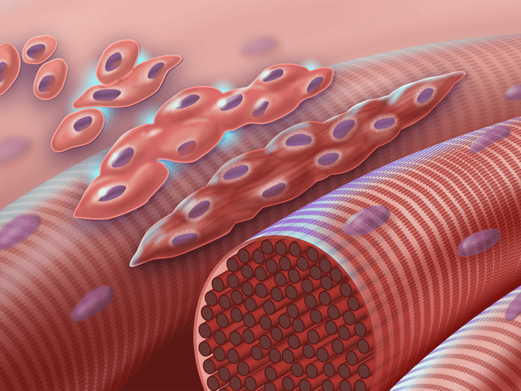 Stem Cells for Muscular Dystrophy