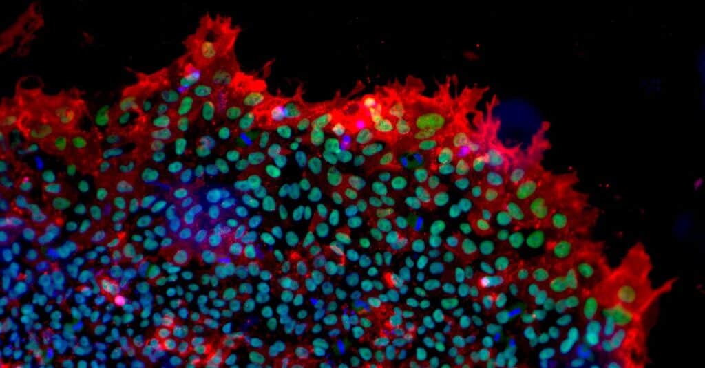 Pluripotent stem cells