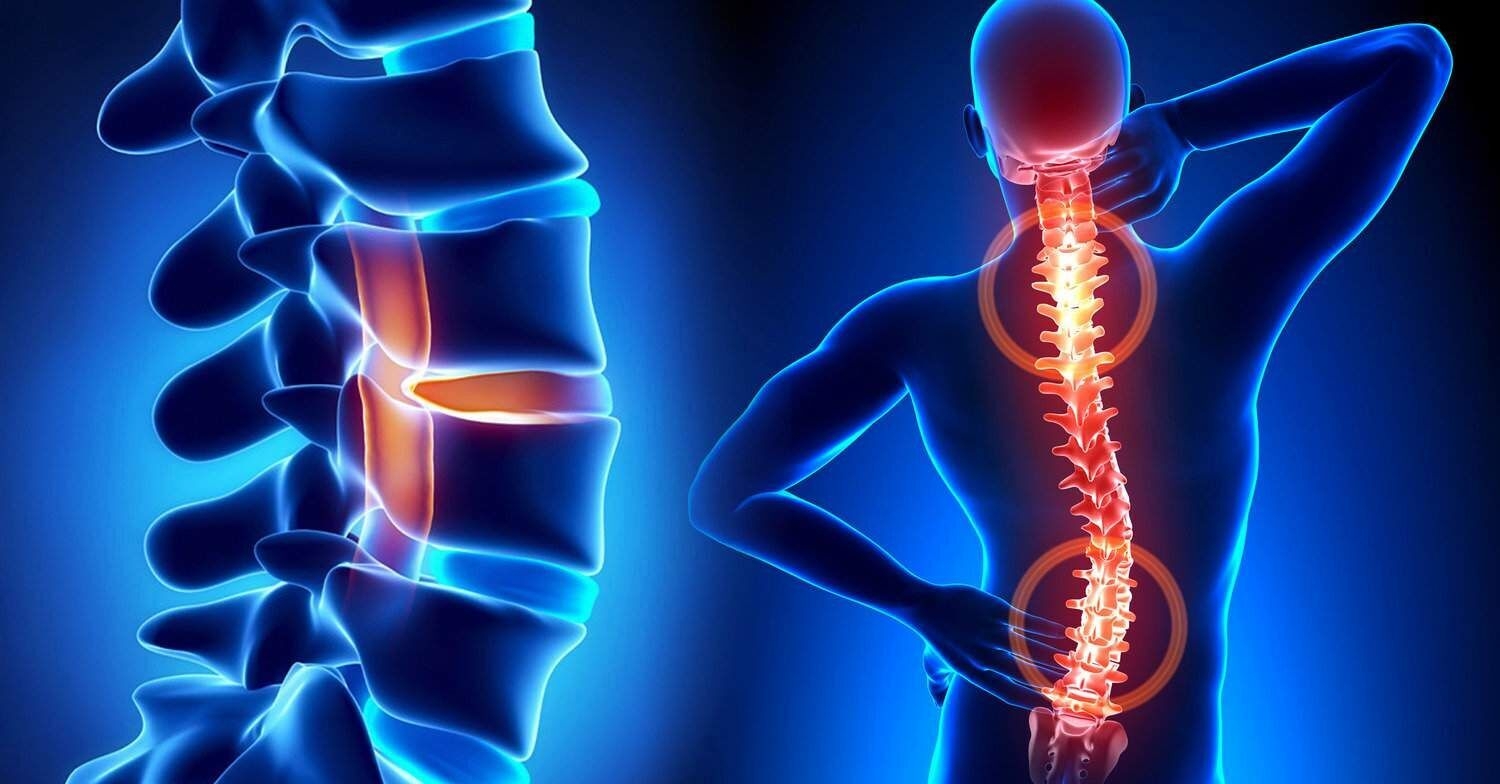 Stem Cell Therapy for Spine