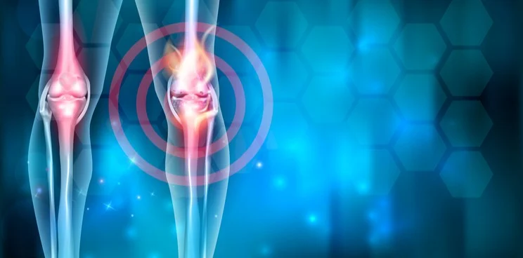 Stem Cell Therapy for Knees