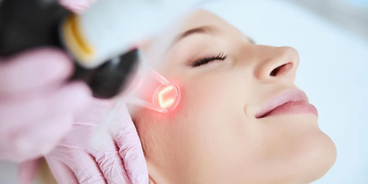 laser skin resurfacing in Mexico