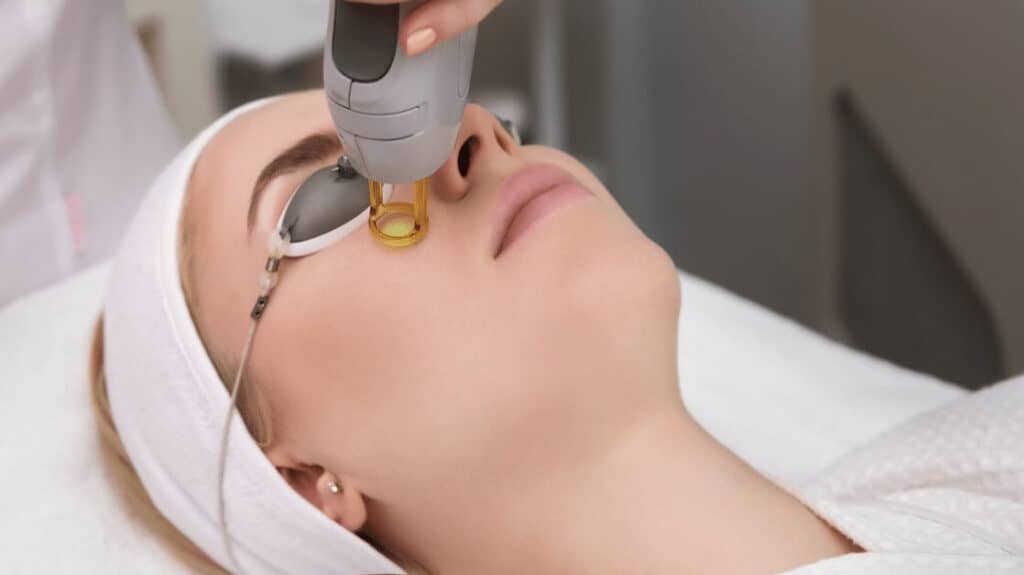 skin laser in Tijuana
