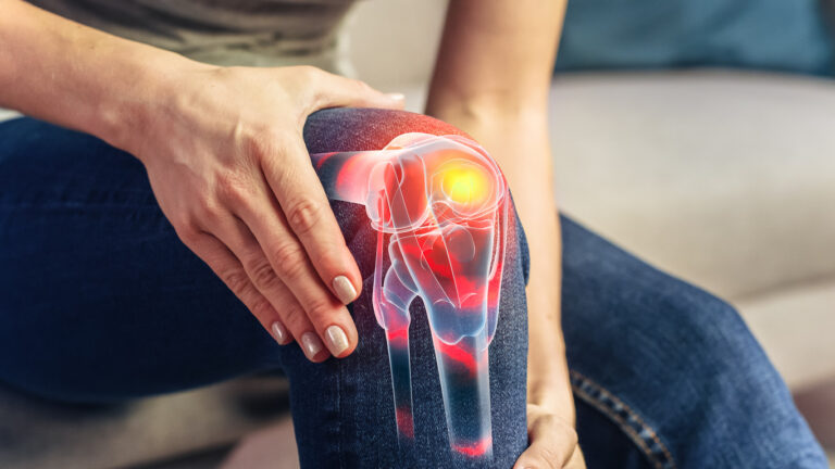 Does Medicare Pay for Stem Cell Therapy for Knees?