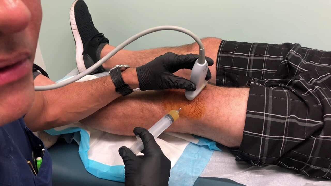 prp for knees in tijuana