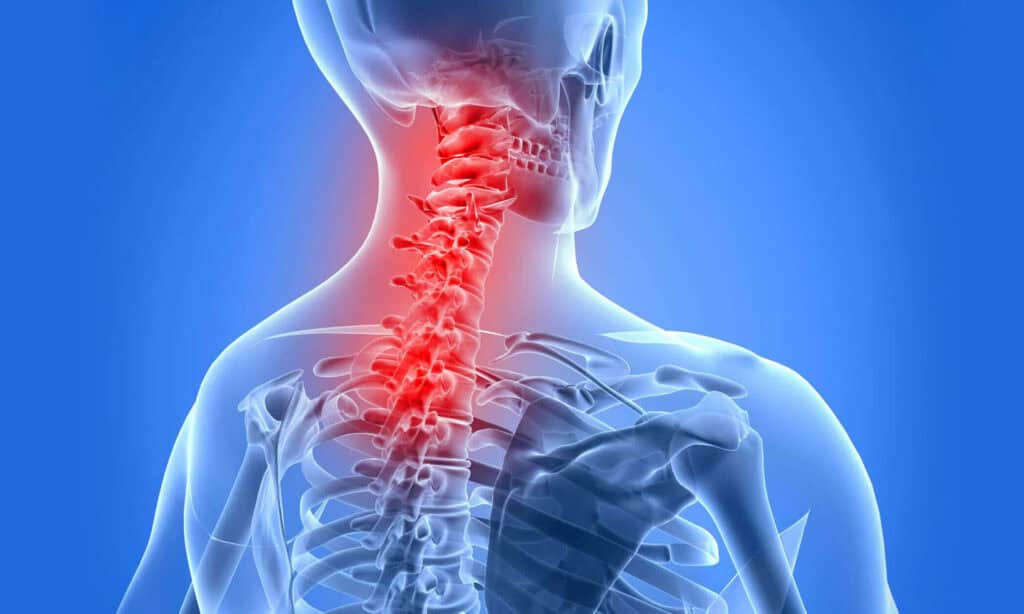 stem cell for ankylosing spondylitis 2