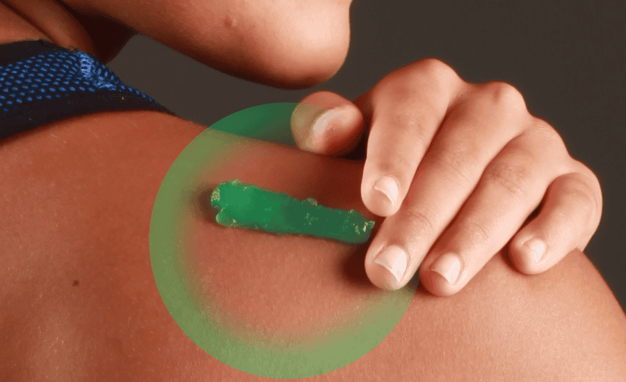 Biofreeze for neuropathy