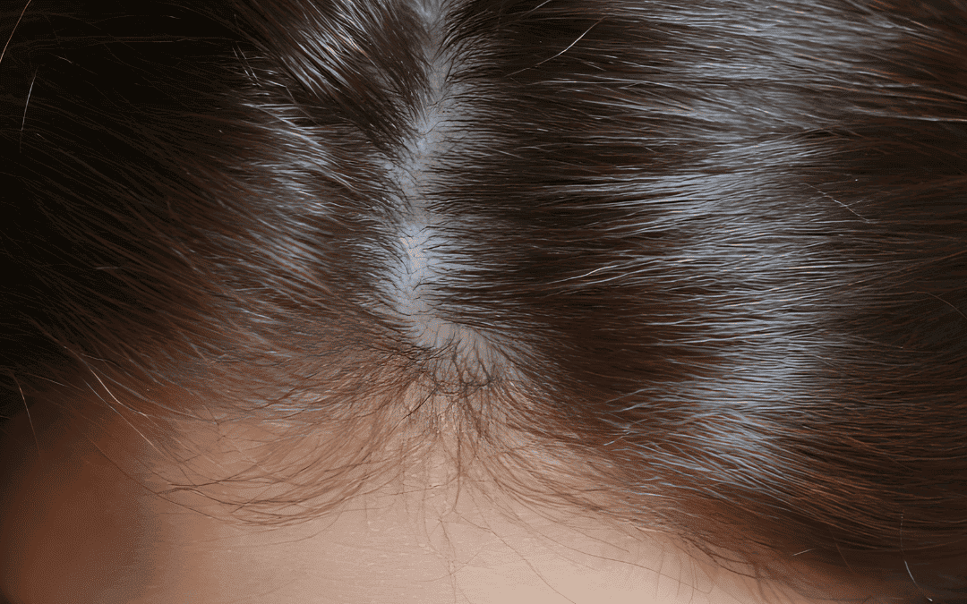 celulas madres para el cabello 2