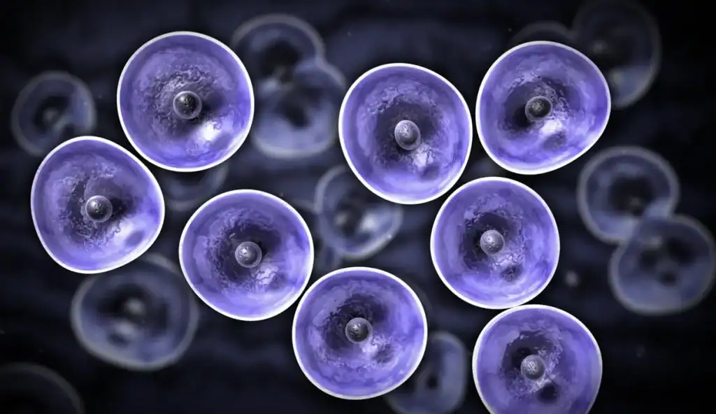 stem cell treatment for autism