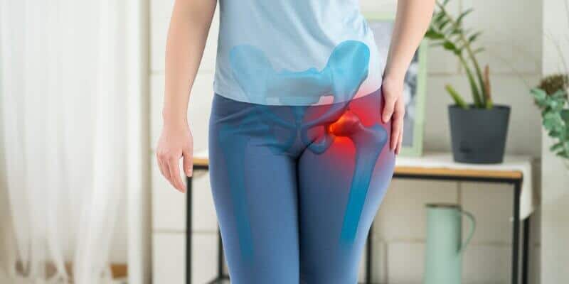 Treatment for Hip Arthritis Without Surgery 2