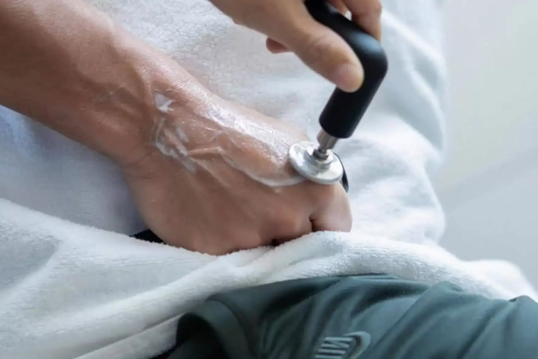 Non-invasive carpal tunnel treatment using ultrasound therapy on a patient's wrist.