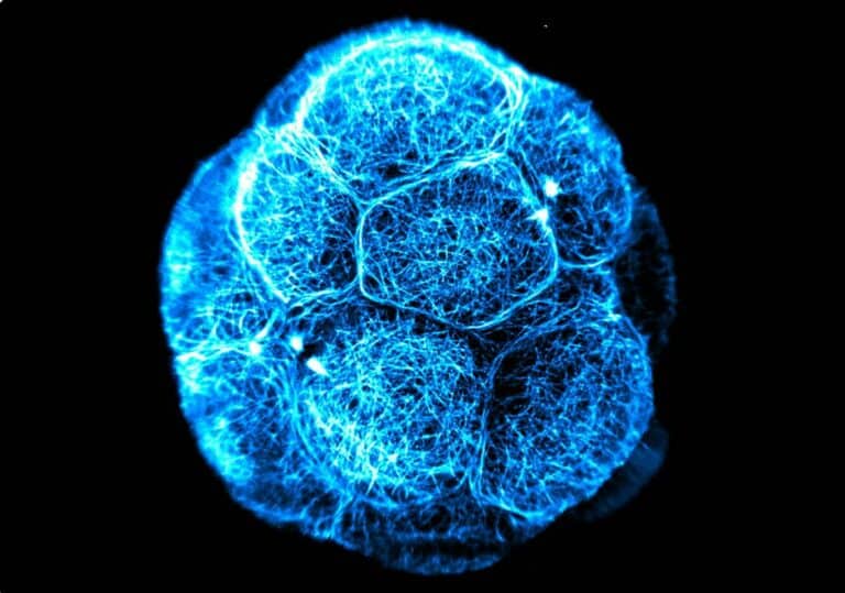 stem cell therapy Tijuana vs USA 2