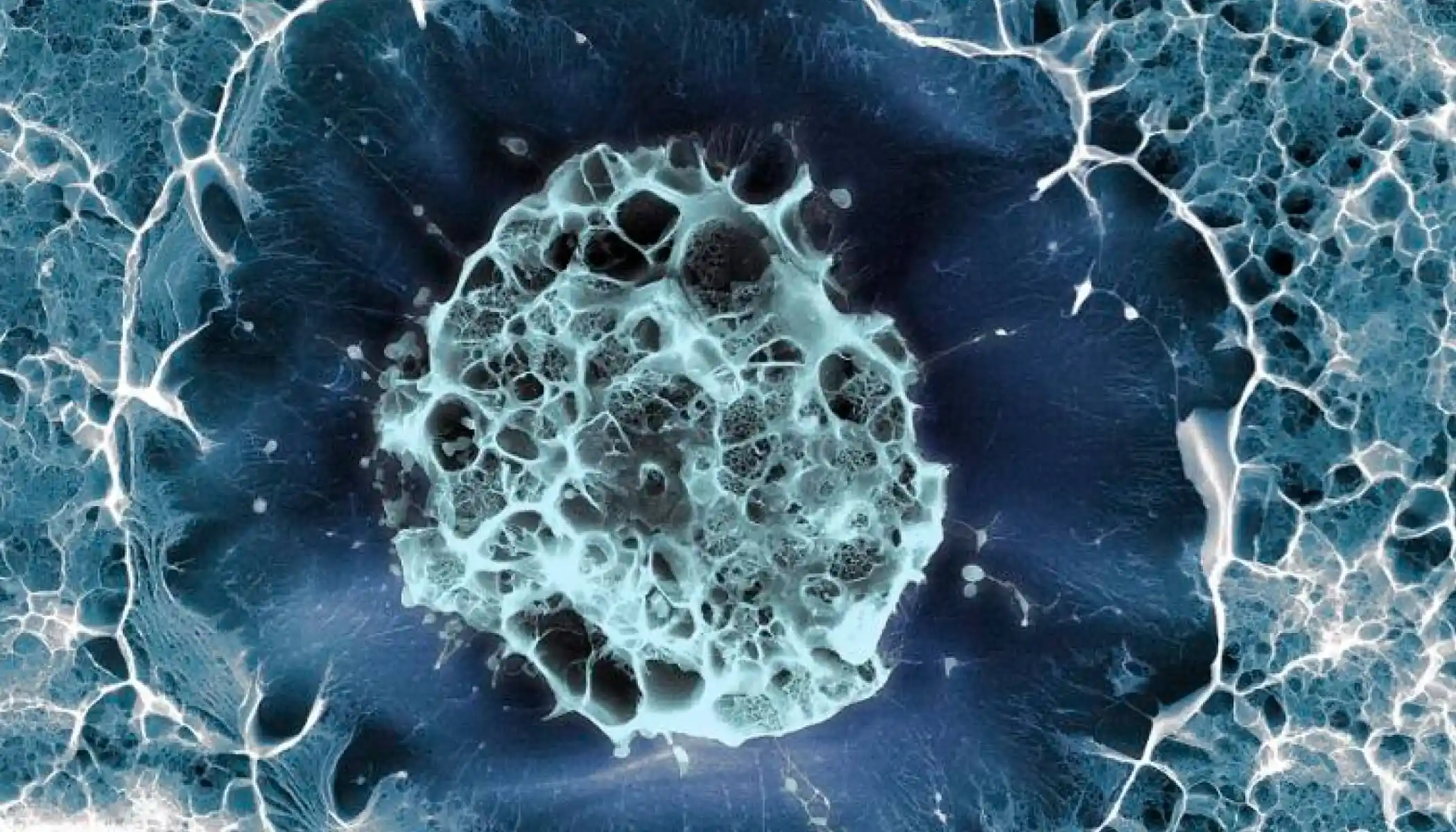 stem cell therapy Tijuana vs USA