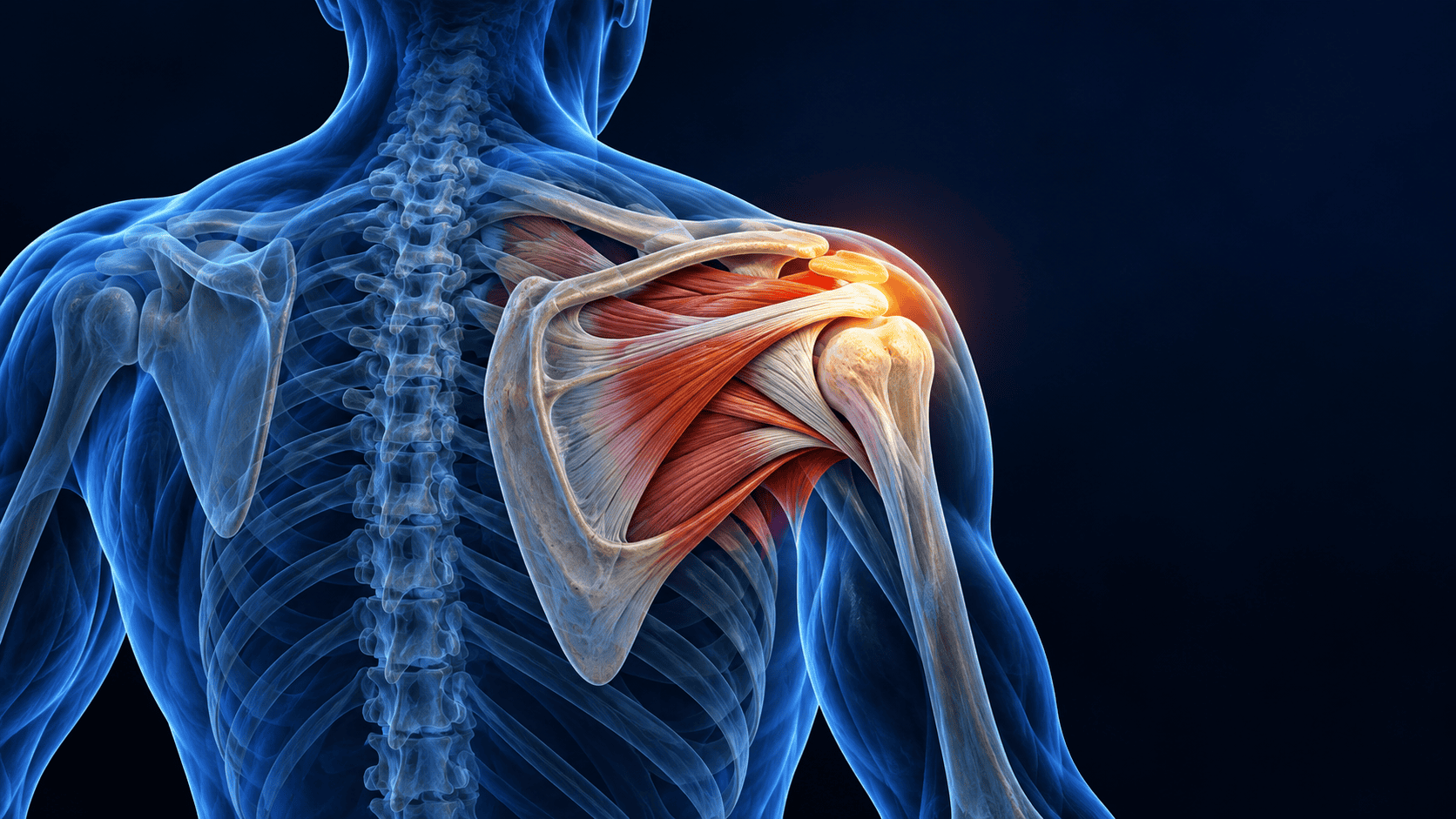 stem cell therapy for shoulder pain 3